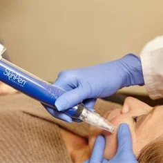 SkinPen® Microneedling