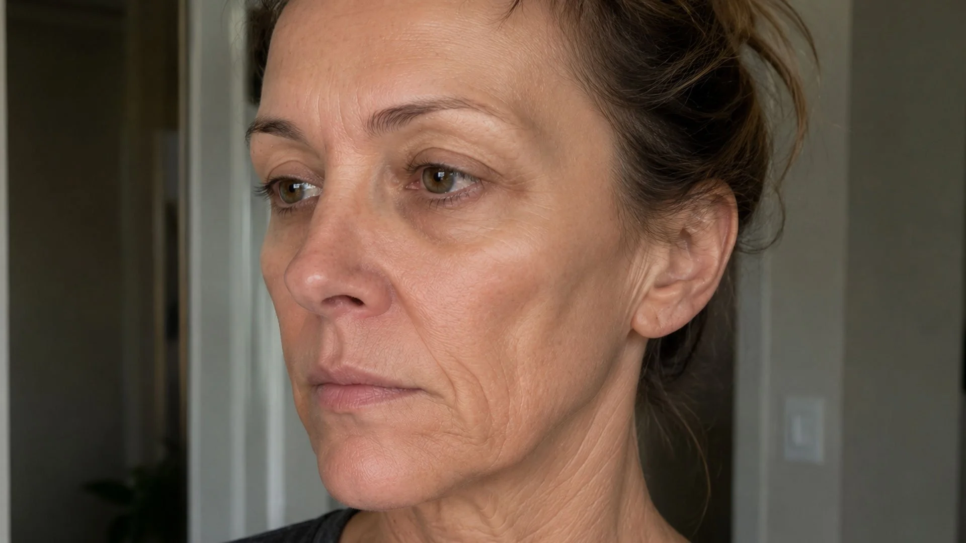 ozempic side effects facial aging