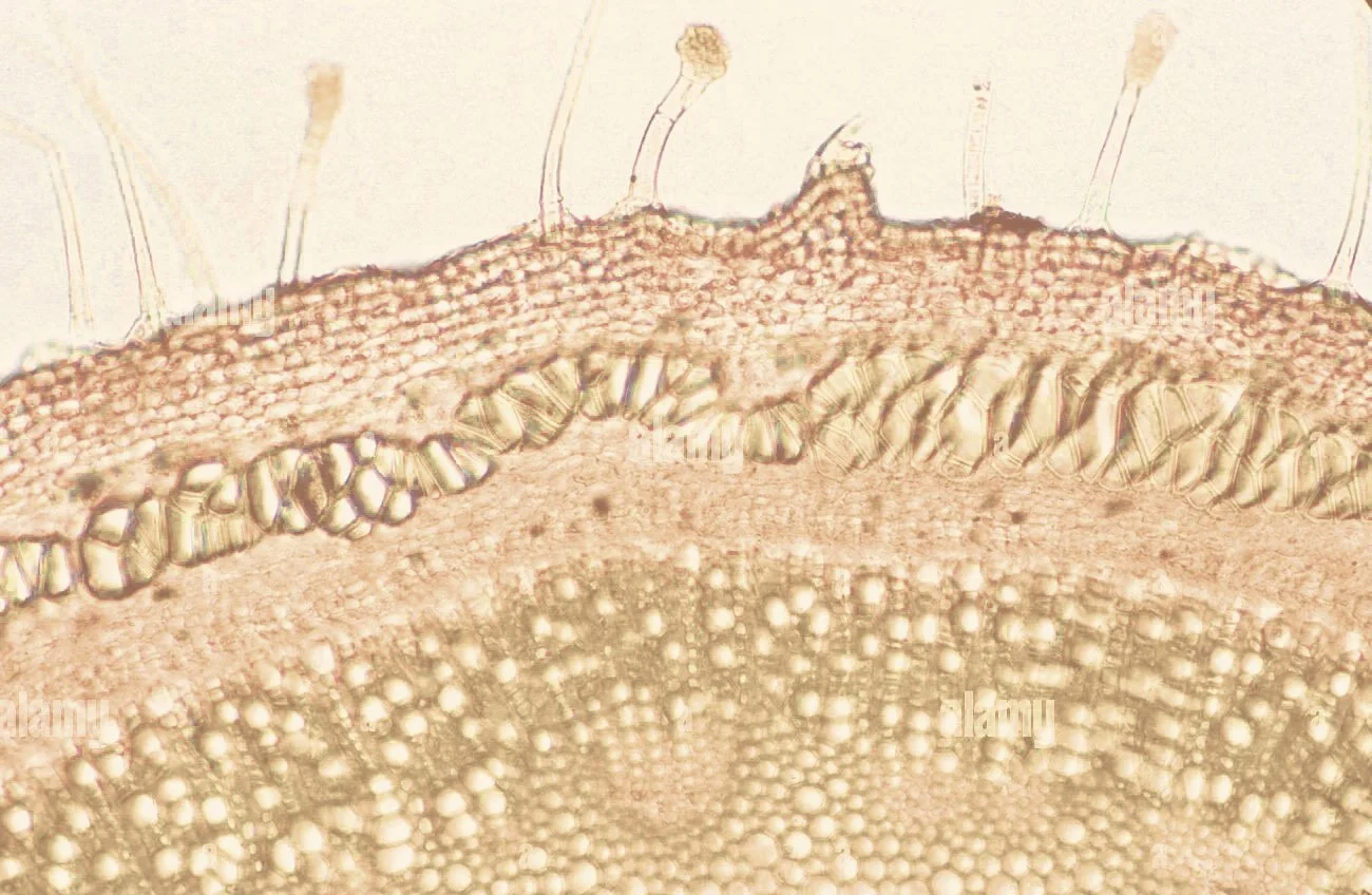 plant-epidermis-with-trichomes-photomicrograph-2DF796W.jpg