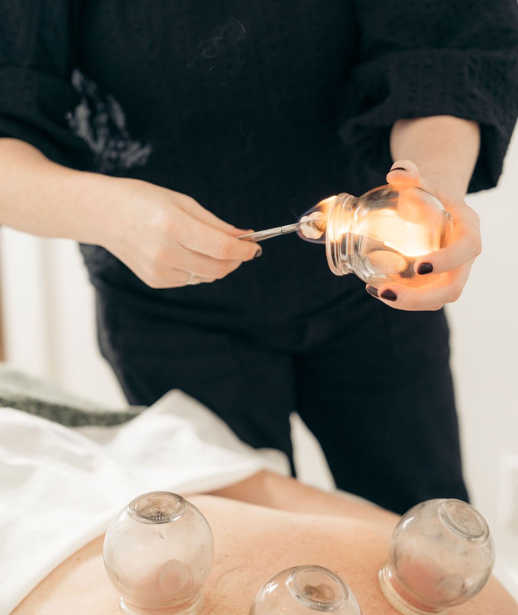 Licensed acupuncturist performing acupuncture and cupping therapy in Squamish, BC