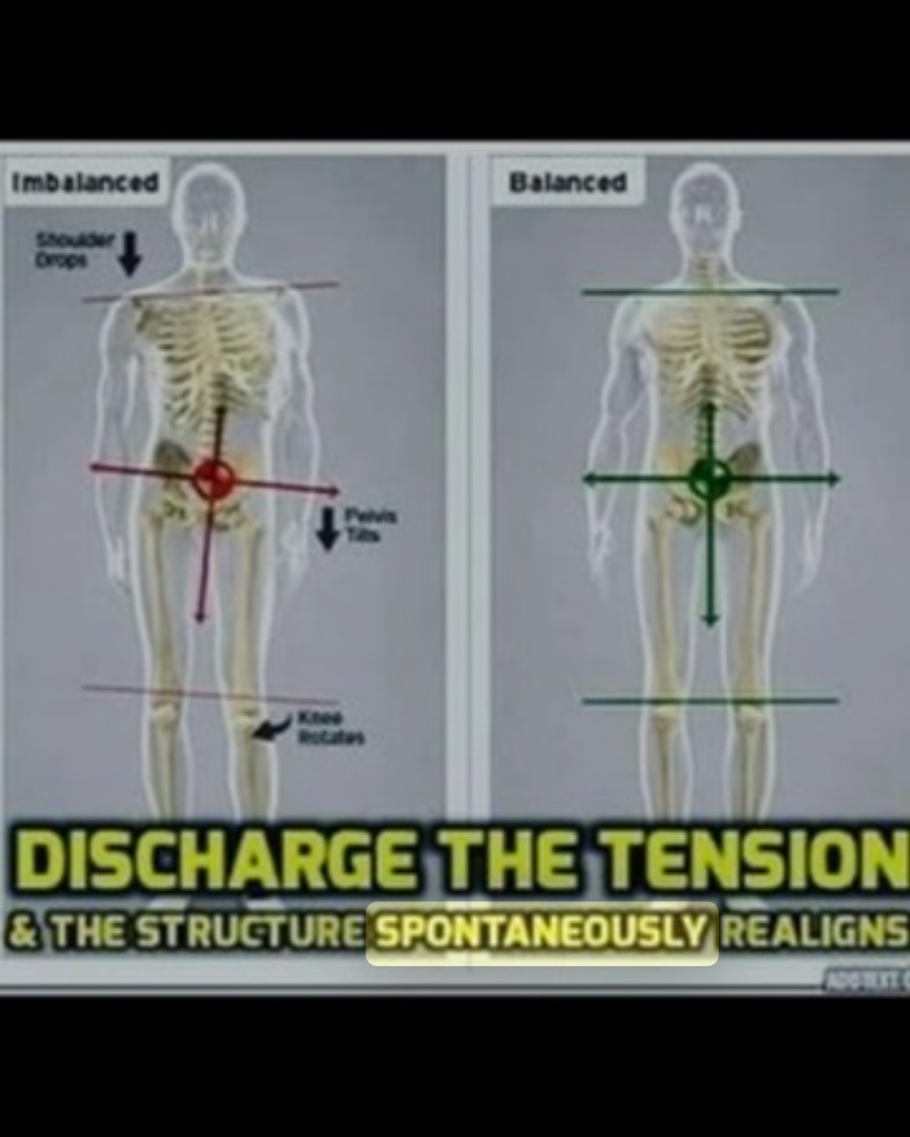 Are You Treating the Pain… or Asking Why the Body Is Still Protecting?