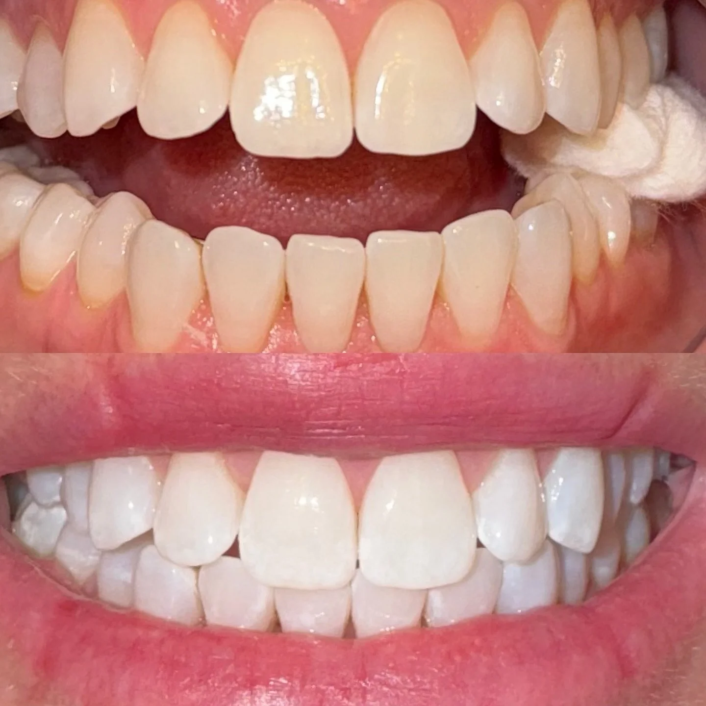 Rachel has been turning bright white smiles out left and right lately! 🤩🦷