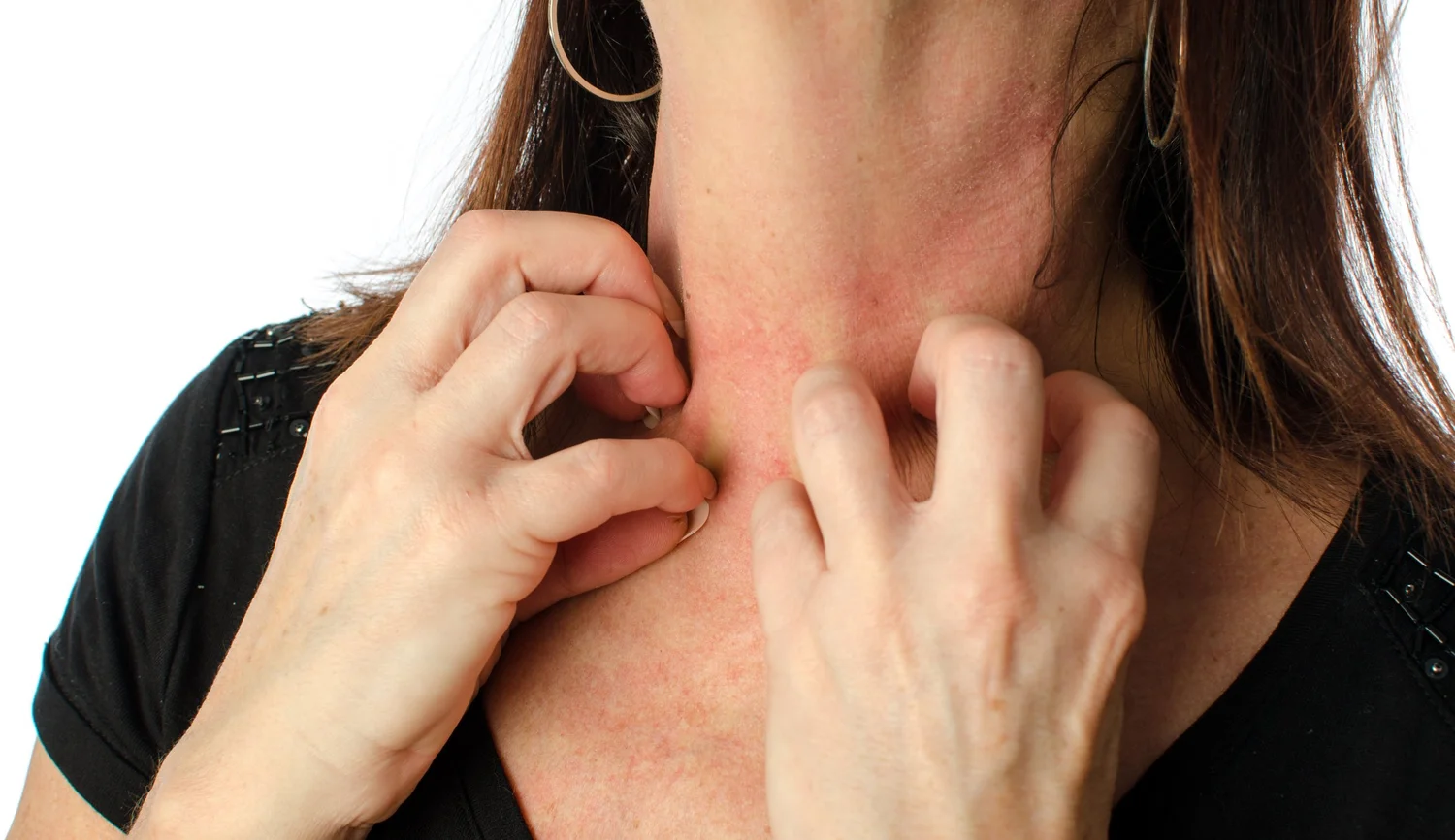 Drug Allergy — Allergy Asthma and Immunology Care Center of Santa Barbara