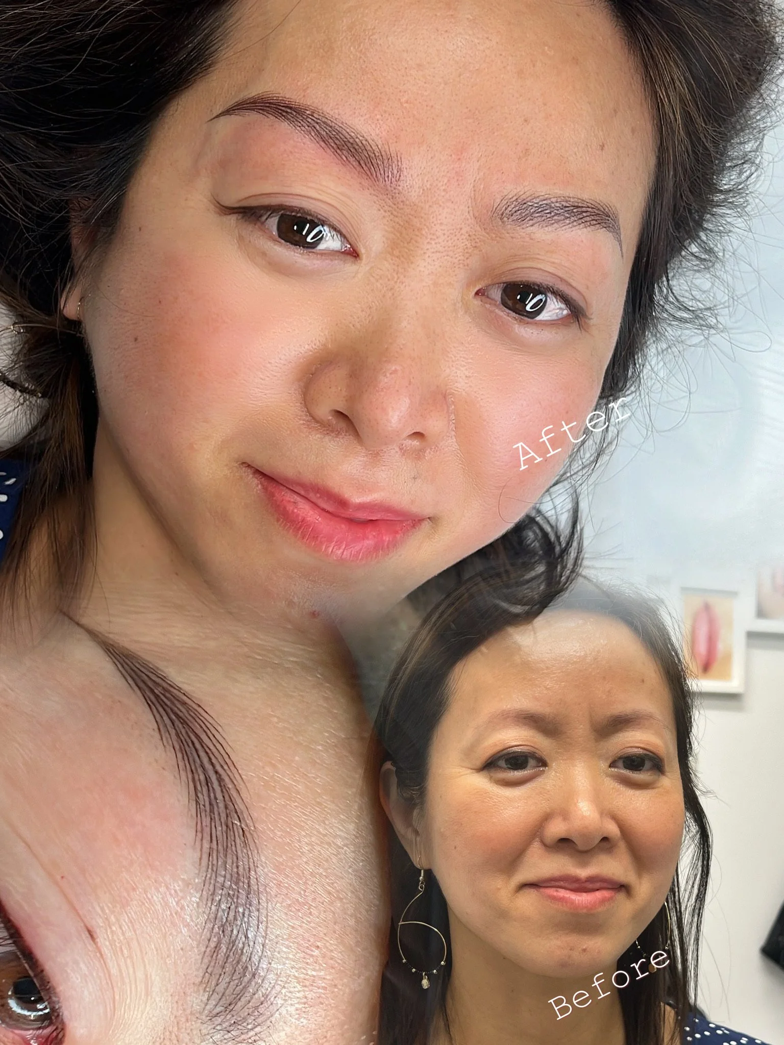 Close-up of a woman's face showing a comparison of her skin before and after a facial or skincare treatment. The 'after' image displays smoother, clearer skin, while the 'before' image shows uneven skin texture and blemishes.
