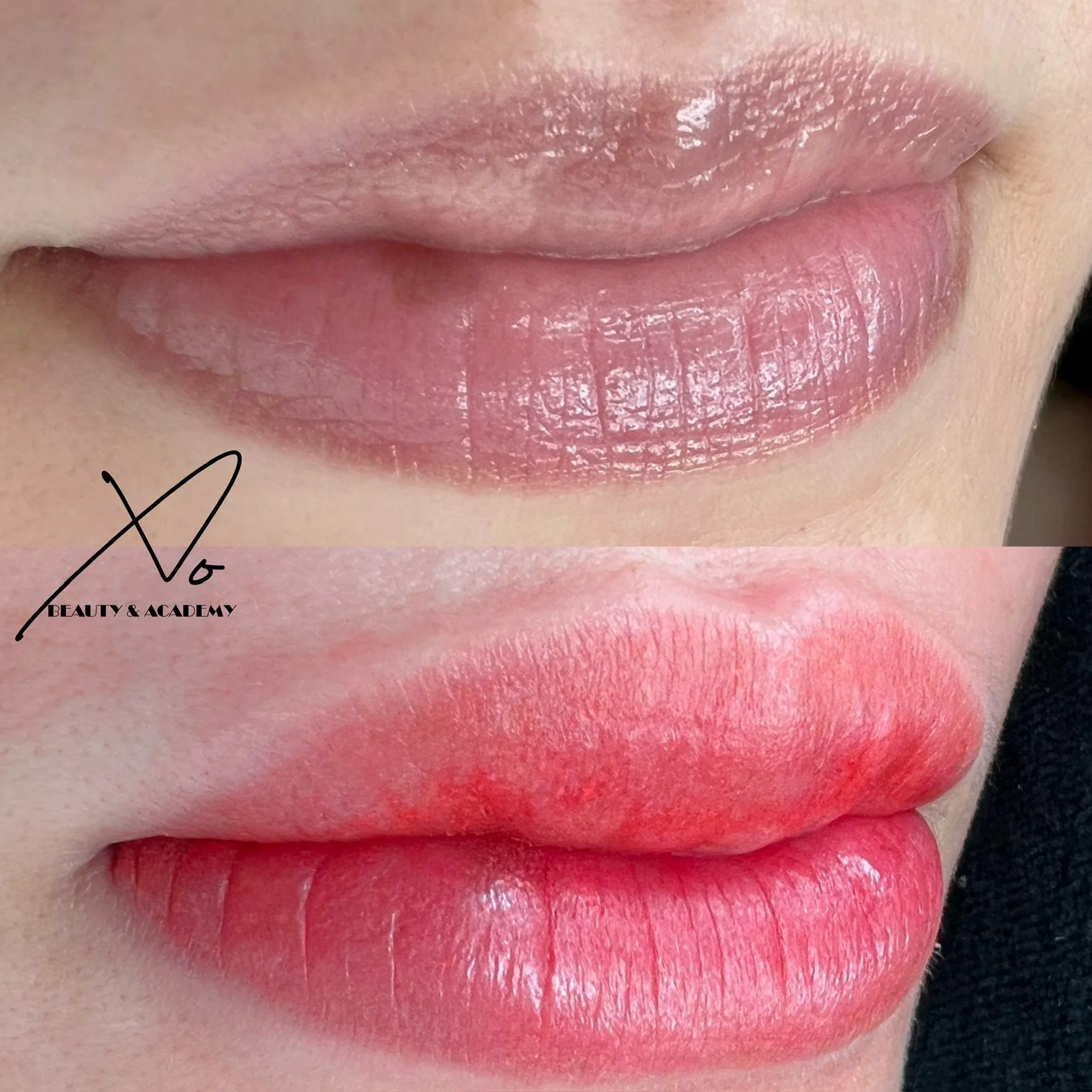 Comparison of lips before and after a cosmetic lip treatment showing improved hydration and color enhancement.