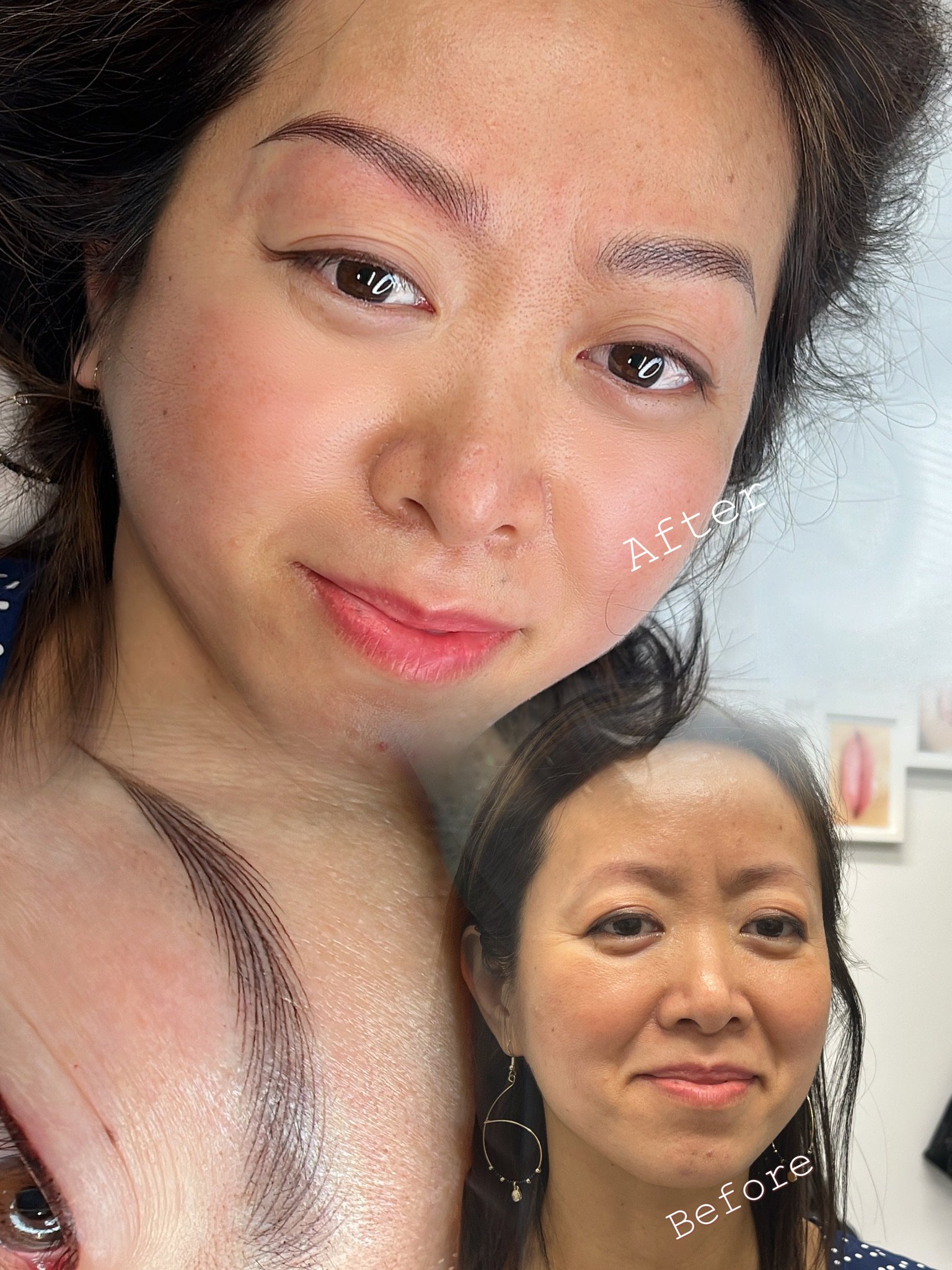 A woman with dark hair before and after a skincare or beauty treatment, showing the effects on her skin.