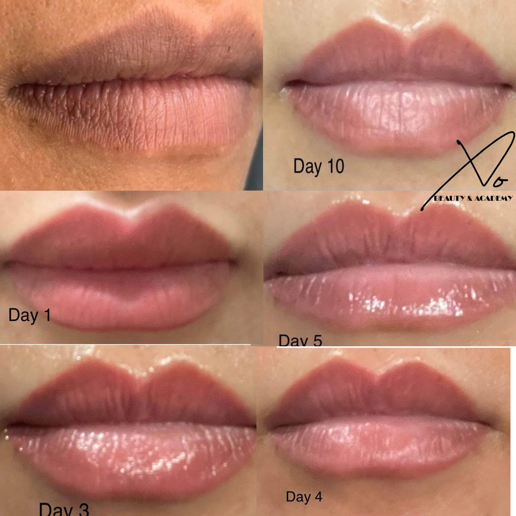 Progression of lips from natural to glossy over ten days, showing daily changes with captions 'Day 1', 'Day 3', 'Day 4', 'Day 5', and 'Day 10'.