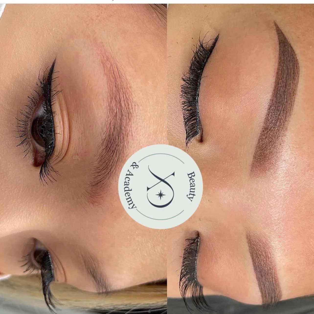 Seattle correction - brow correction - Fix your old brow bad works
