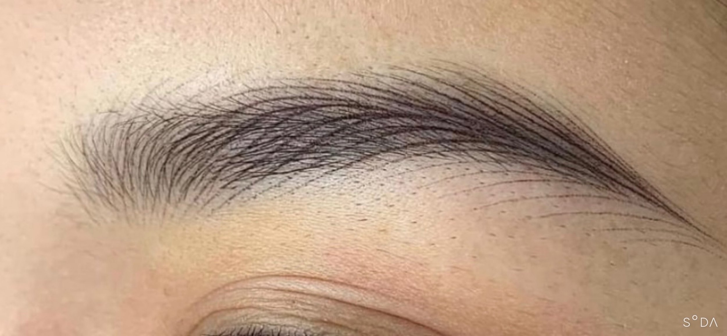 Close-up of a person's eyebrow and forehead area.