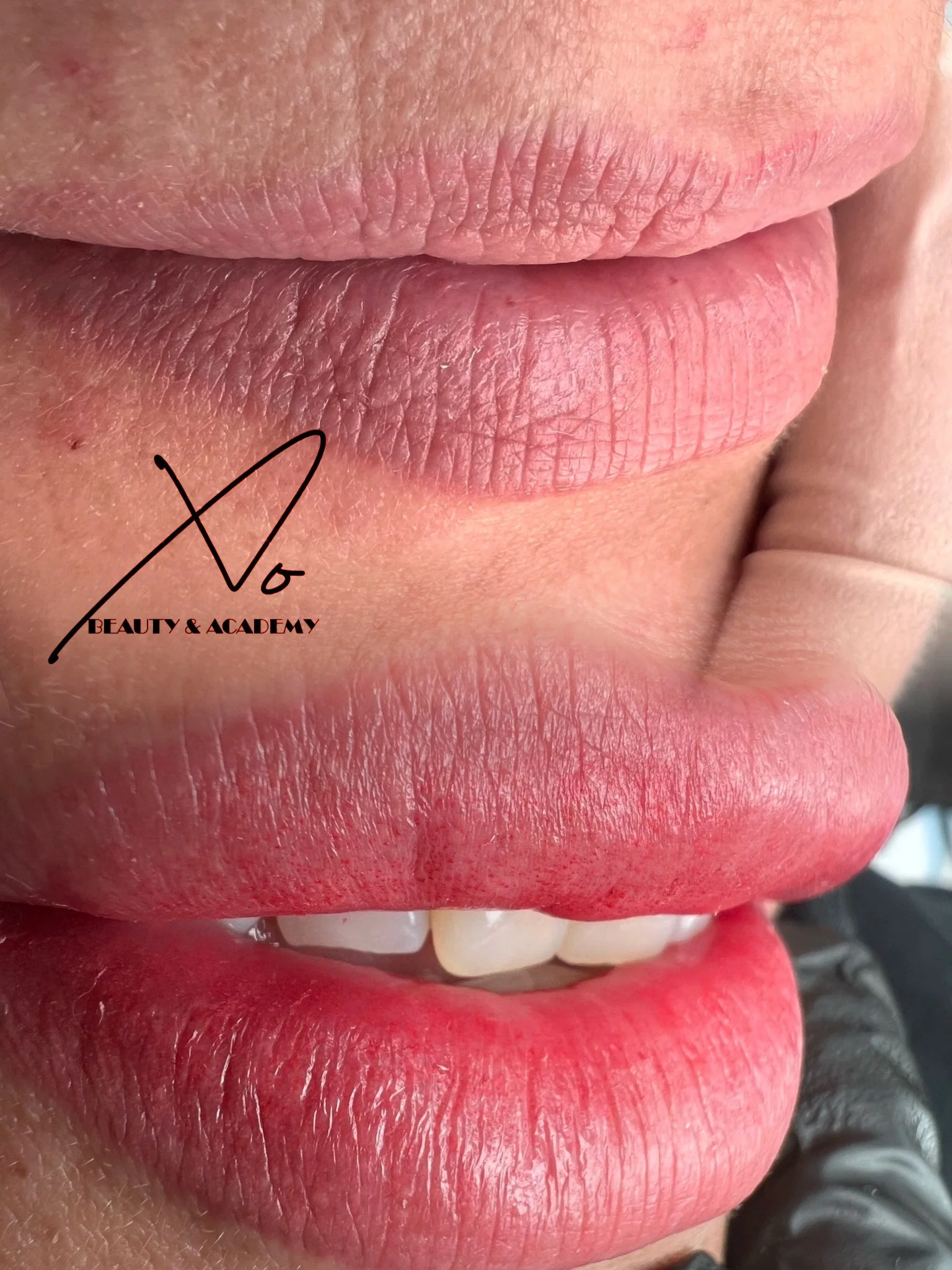 Close-up of lips with natural and lipstick application, showing texture and color.