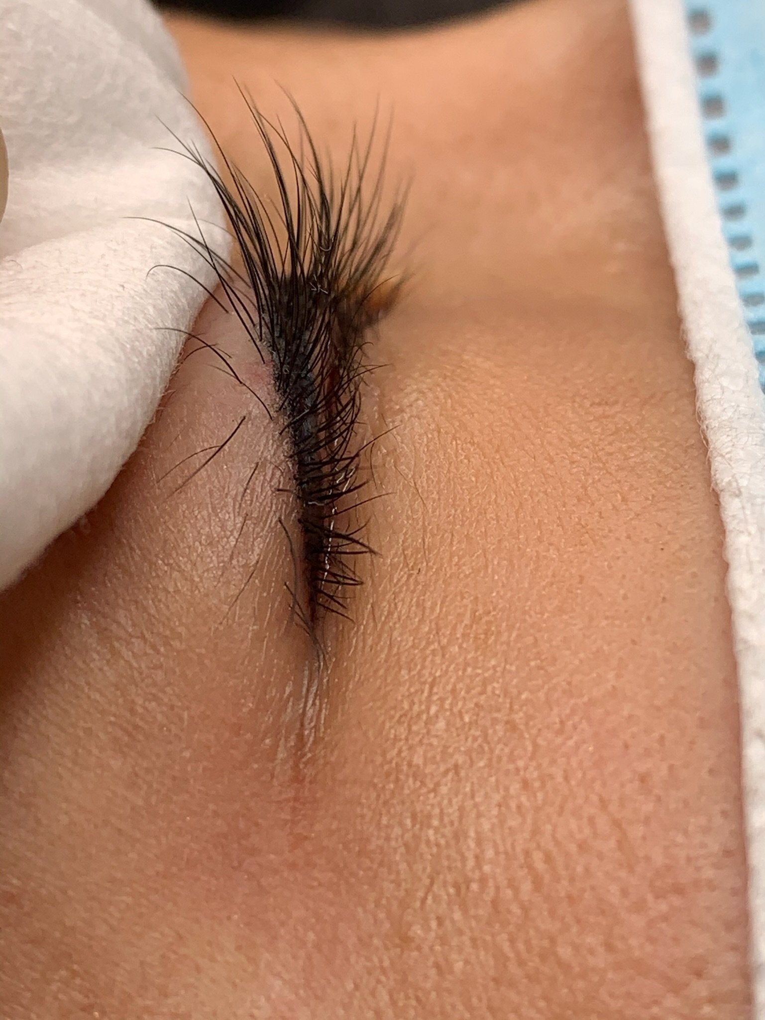 Close-up of a person's closed eye with long eyelashes, an eyebrow, and some skin texture visible, possibly during a beauty procedure or medical examination.
