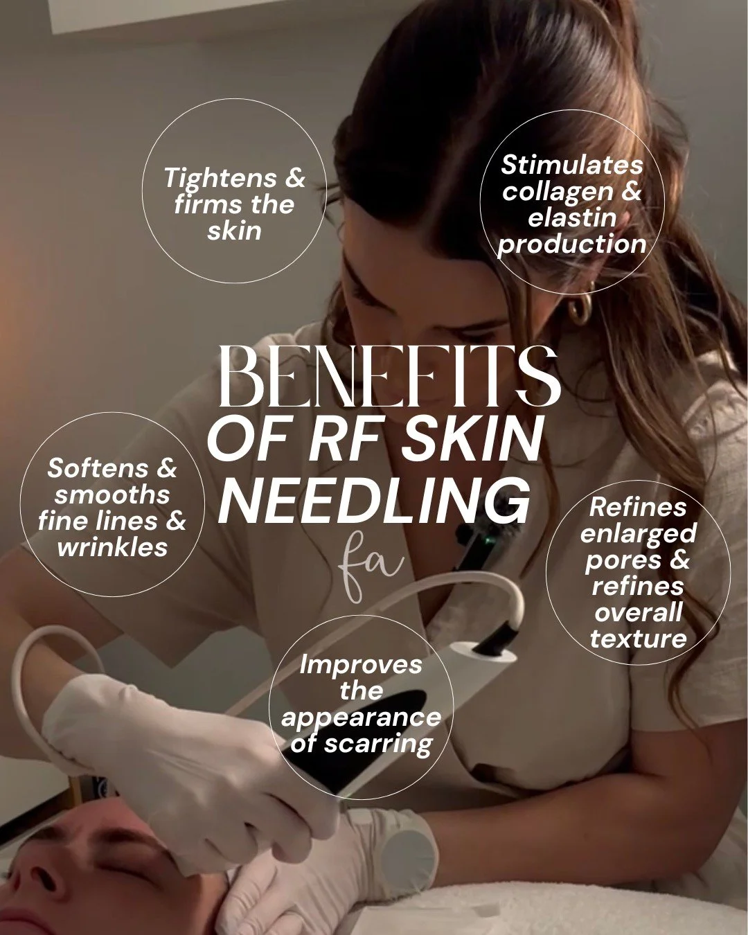 RF SKIN NEEDLING, EXPLAINED ✨

RF Skin Needling combines controlled skin needling with radiofrequency energy to stimulate collagen and elastin, helping to strengthen, smooth and rejuvenate the skin.

At Facial Attraction, our Divine Pro gives us two 