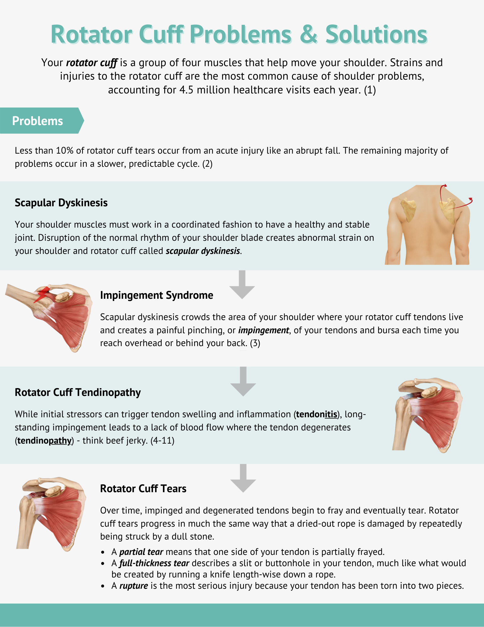 Understanding the Causes of a Rotator Cuff Injury: J. Michael