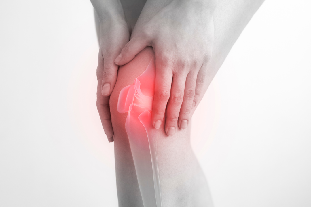 Iliotibial Band Syndrome (ITBS)  Central Coast Orthopedic Medical Group