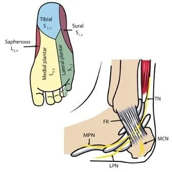 Shop medial plantar nerve pain treatment Top Sellers