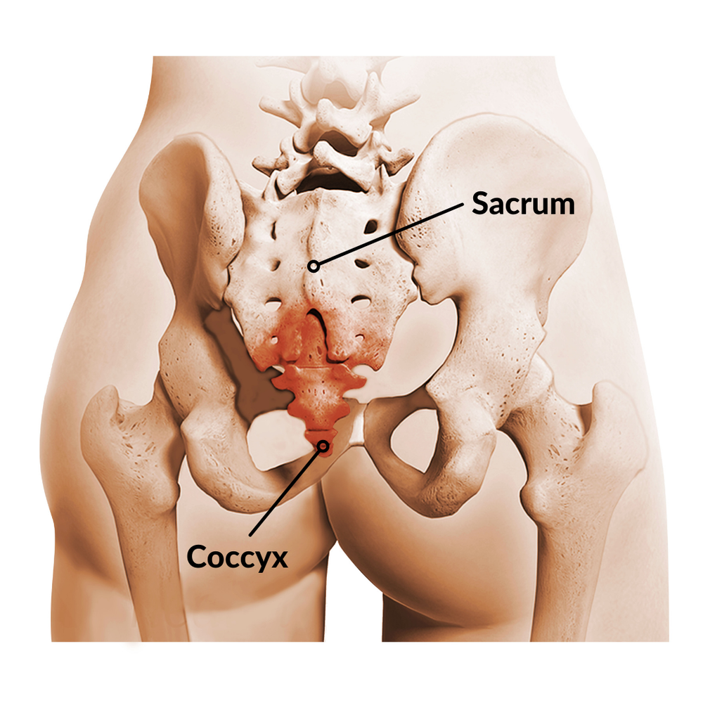 What Is Tailbone Pain/Coccydynia? Symptoms, Causes, Diagnosis &  Physiotherapy Treatment Of Tailbone Pain/Coccydynia