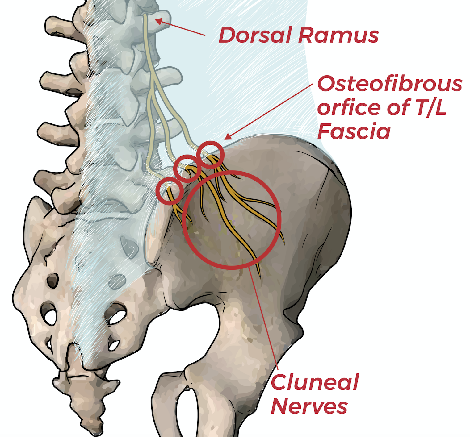 An Elusive Cause of Severe Recurrent Flank Pain: Case Quiz