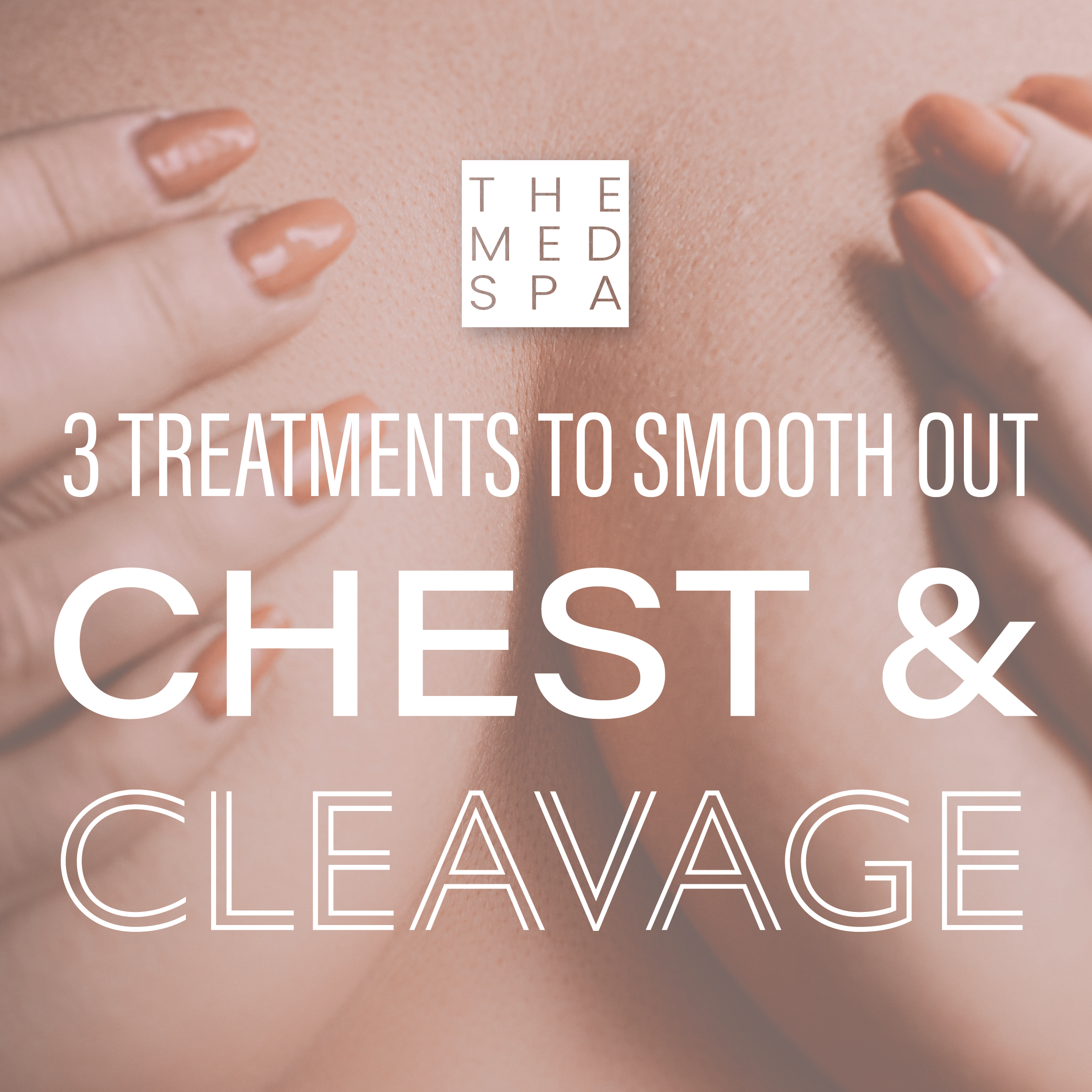 Smooth Out Chest and Cleavage Wrinkles with These 3 Treatments — THE MED SPA