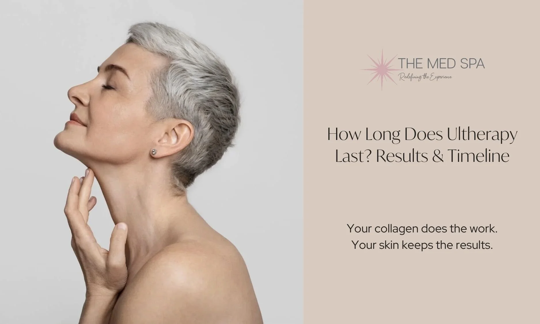How Long Does Ultherapy Last