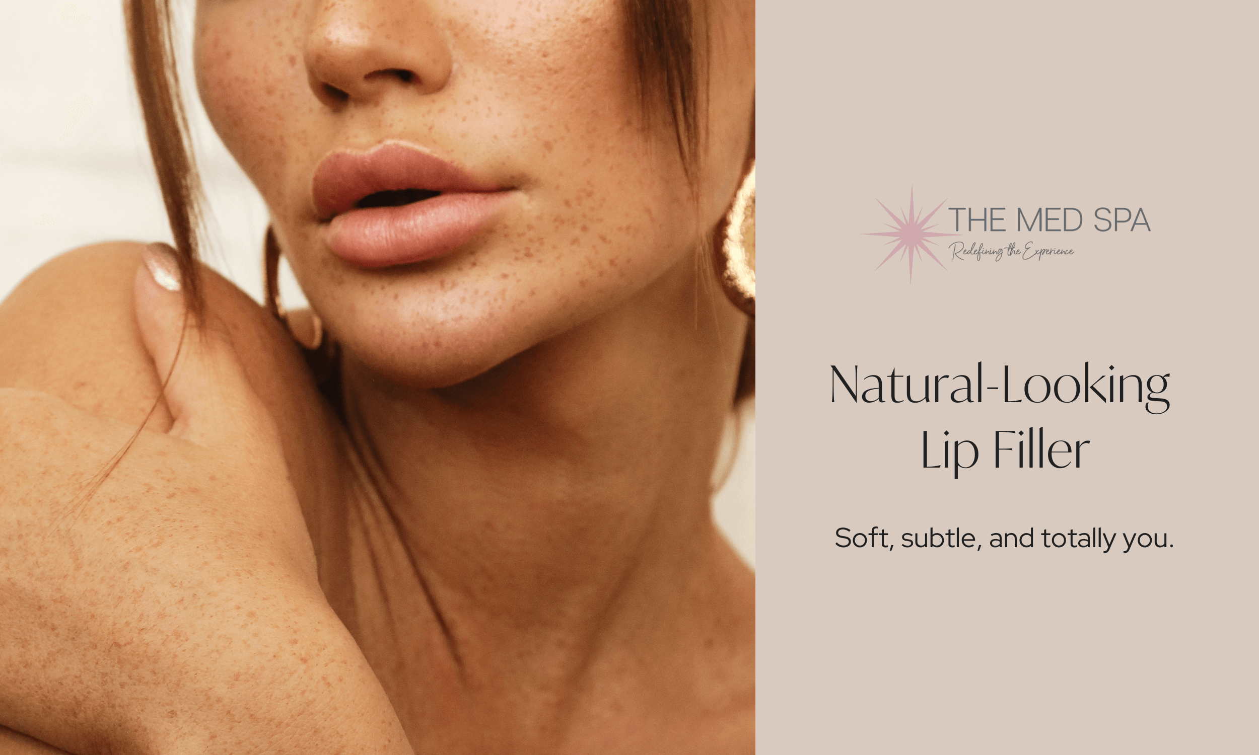 Natural-Looking Lip Filler in Woodury, MN. Soft, subtle, and totally you with The Med Spa Woodbury!