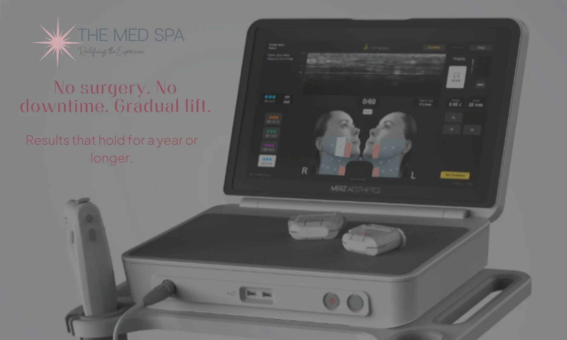How Long Does Ultherapy Last