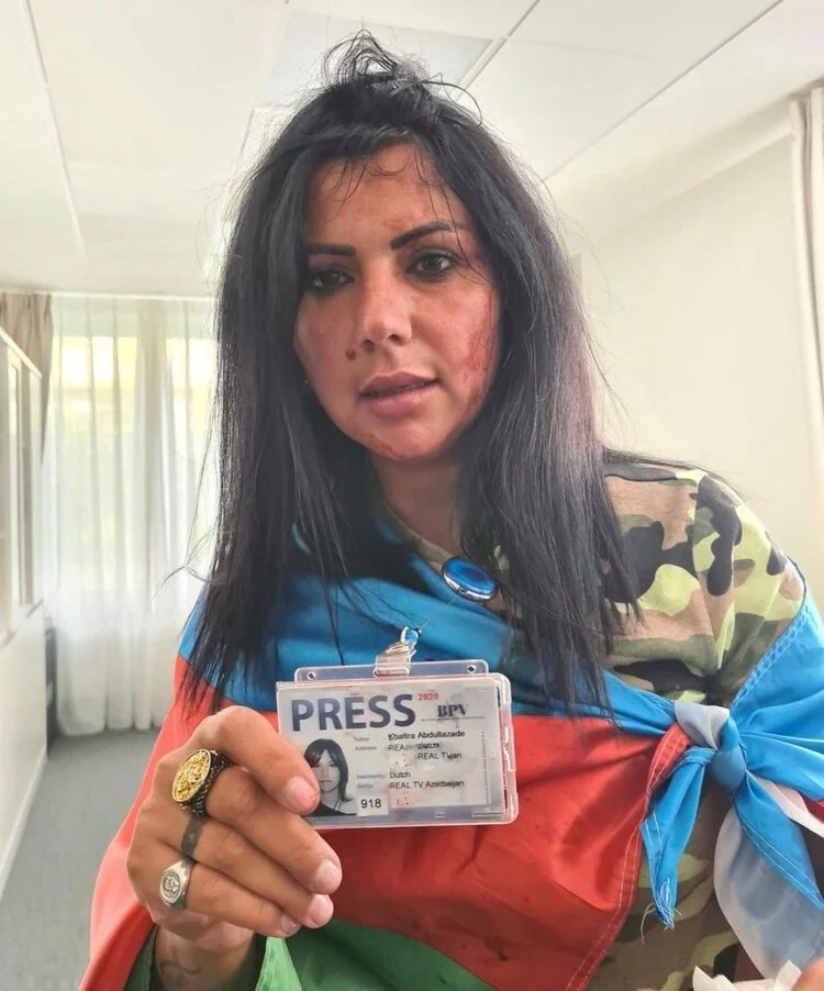 Belgium: CFWIJ Is Concerned For Khatira Sardargizi As She Faces Horrific Assault