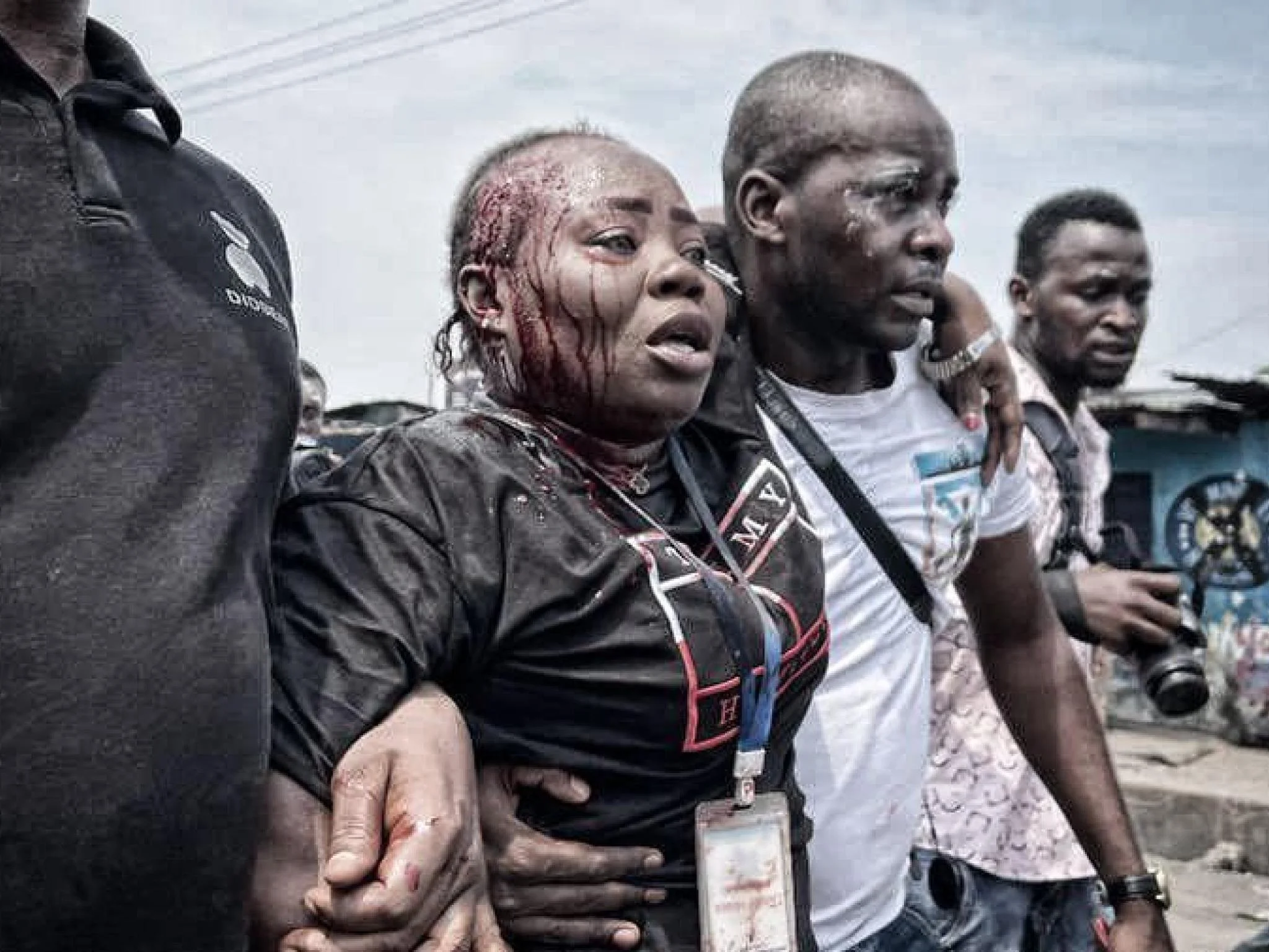 DRC: Protestors Slash Journalist Geonne Djokwa With Machete, Threaten Prisca Yasetonga