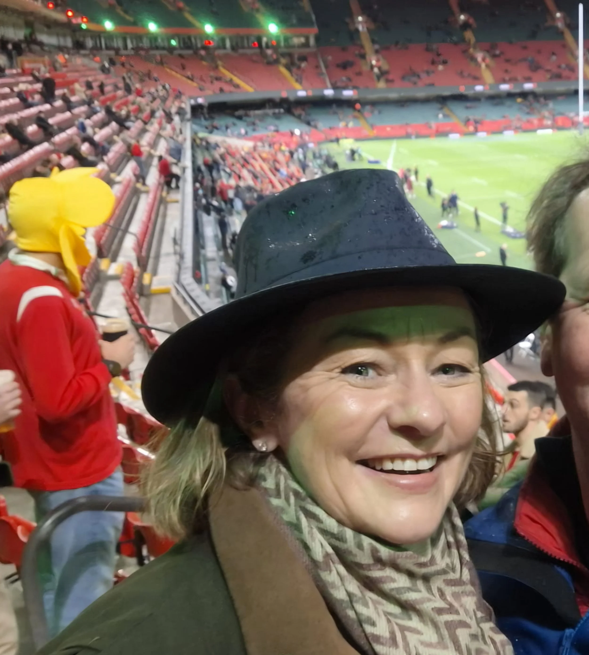 Lorna shares her journey with Sheehan’s Syndrome