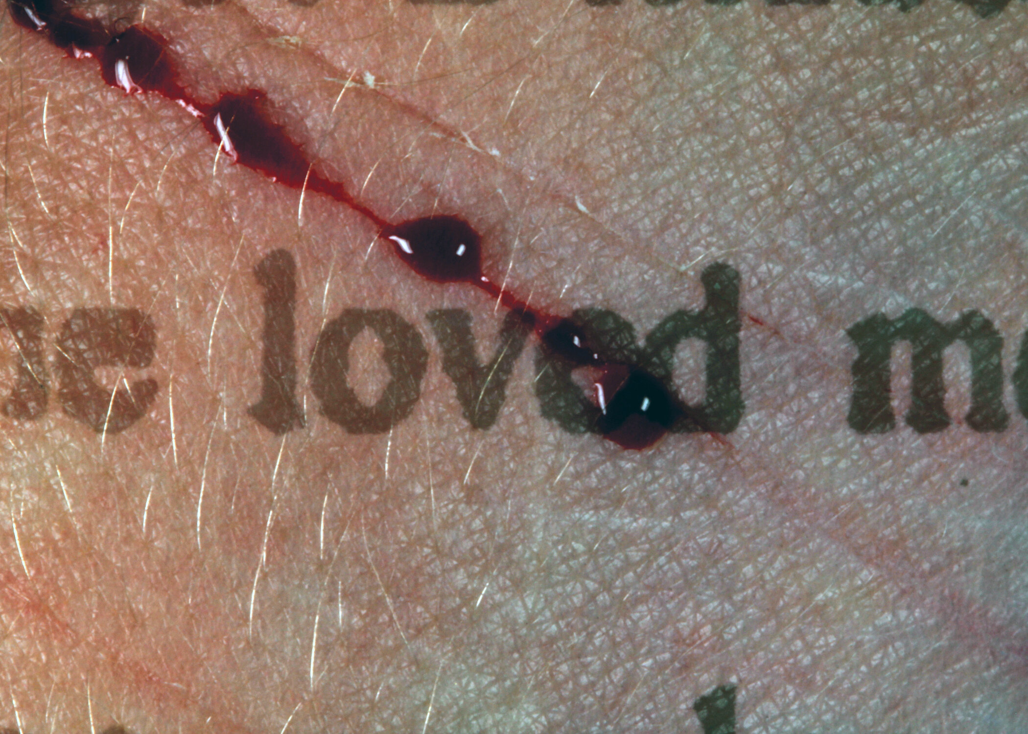 It Started With a Murder — Susan Young