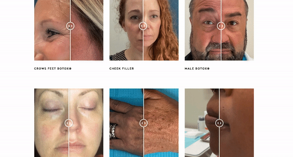 A Younger You Ohio Before and After Results