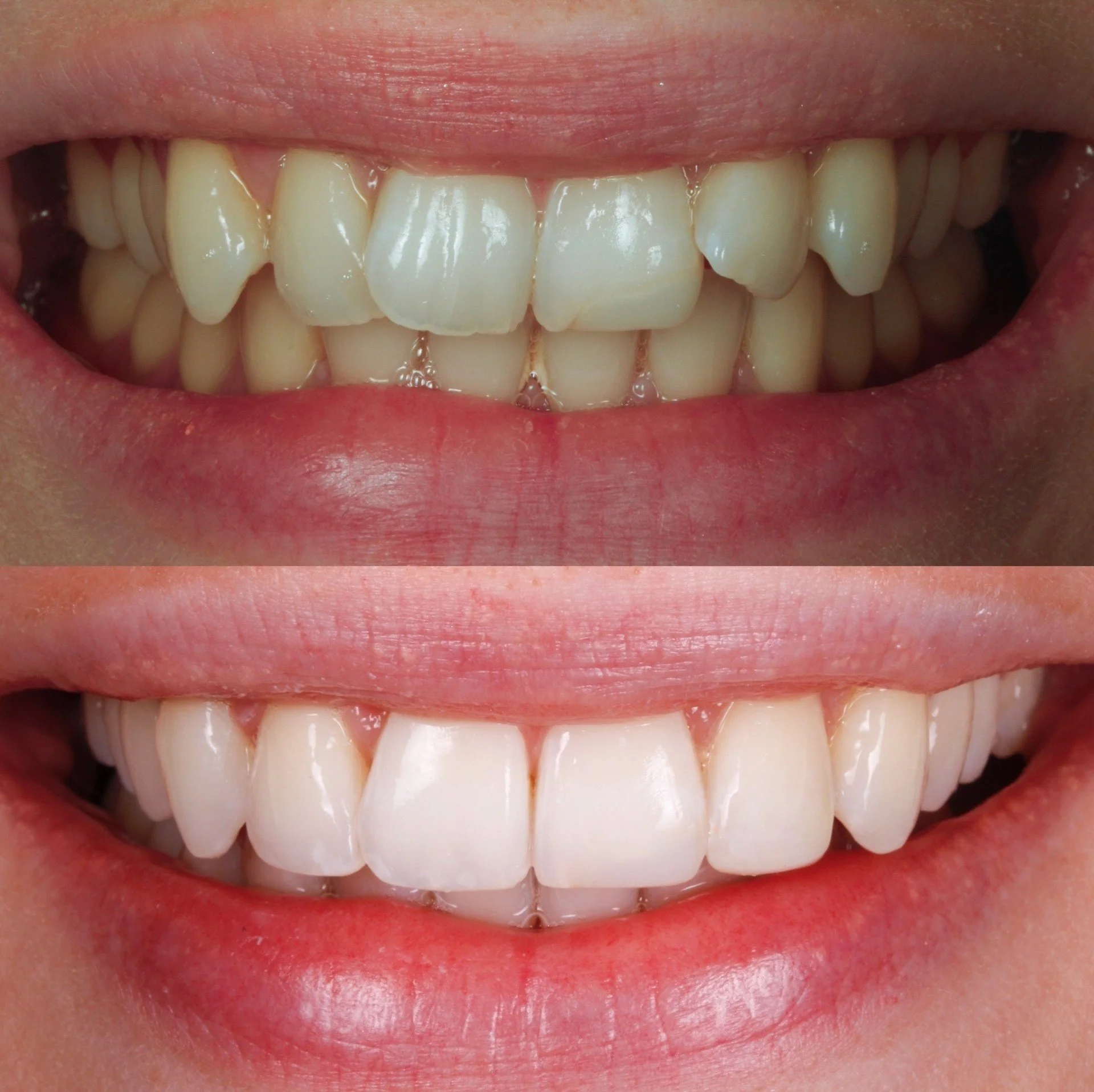 beforeafter hane.jpg