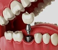 Oral and Maxillofacial Surgery Associates of Nevada