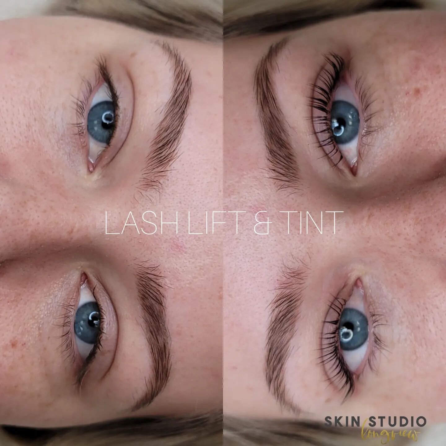 We did a lash lift &amp; tint. Her brows are 4 weeks healed after her first session. I cannot wait to see them after her touchup!! 💕
 𝑮𝒊𝒇𝒕 𝒄𝒂𝒓𝒅𝒔 𝒂𝒗𝒂𝒊𝒍𝒂𝒃𝒍𝒆 𝒐𝒏𝒍𝒊𝒏𝒆
 𝑩𝒐𝒐𝒌𝒊𝒏𝒈, 𝑭𝑨𝑸𝒔, 𝒎𝒐𝒓𝒆 𝒊𝒏𝒇𝒐 👇
www.skinstudiol