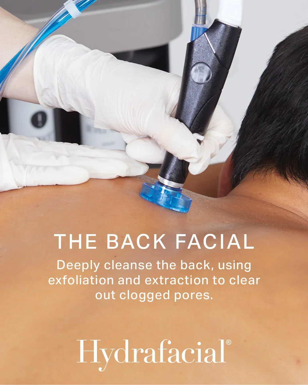 Reveal Clearer, Smoother Skin with HydraBody Treatments