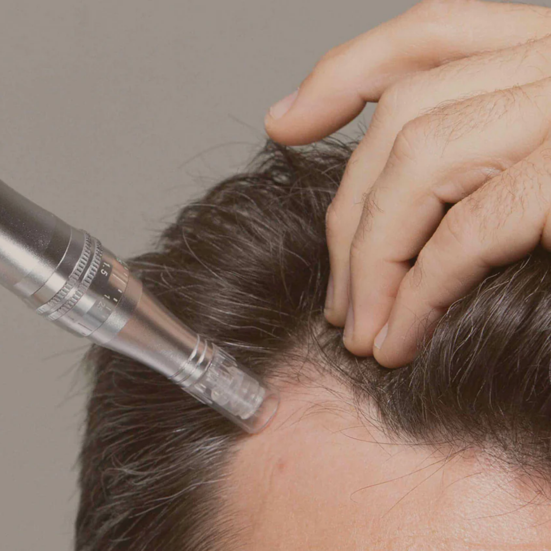 A Non-Surgical Approach to Thicker, Healthier Hair