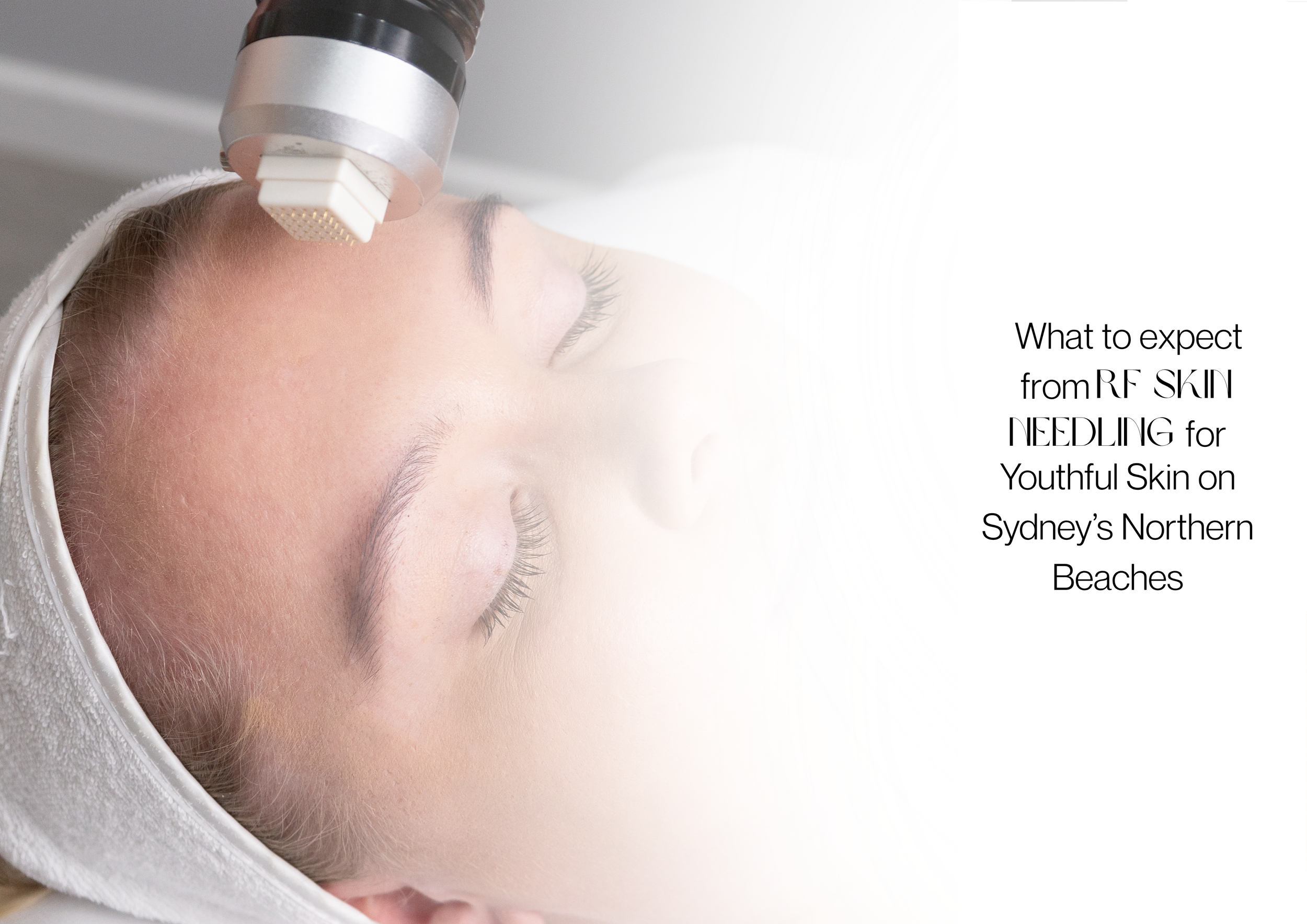 What to Expect from RF Skin Needling for Youthful Skin on the Northern Beaches