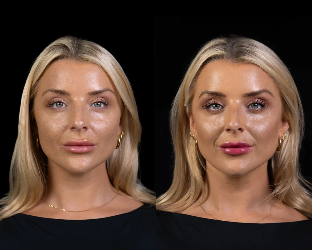 Before and after result 1