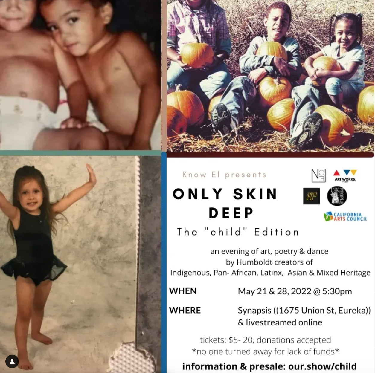 Only Skin Deep: The "Child Edition