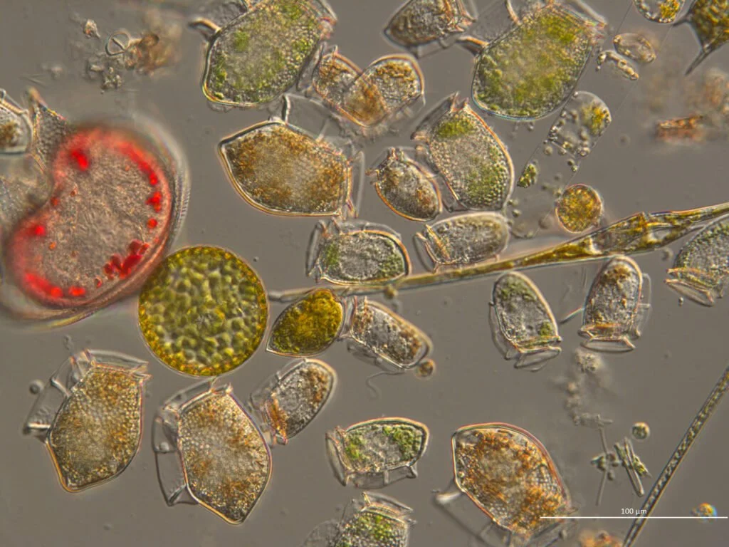 Study provides detailed assessment of shifts in toxin-producing phytoplankton abundance