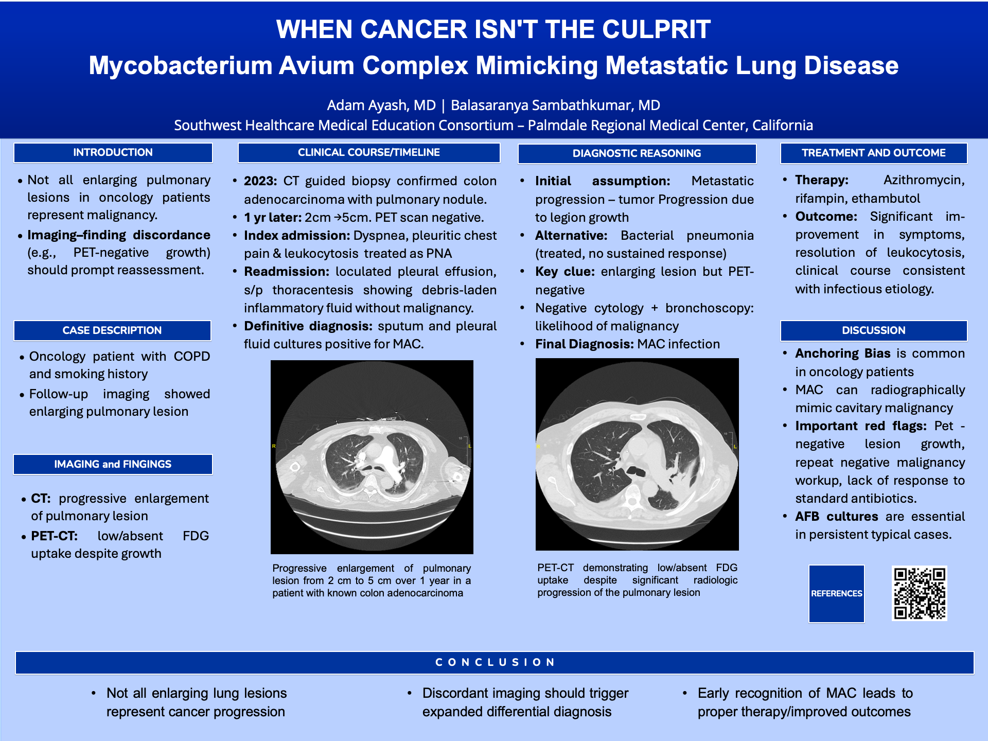 When Cancer Isnt The Culprit.png