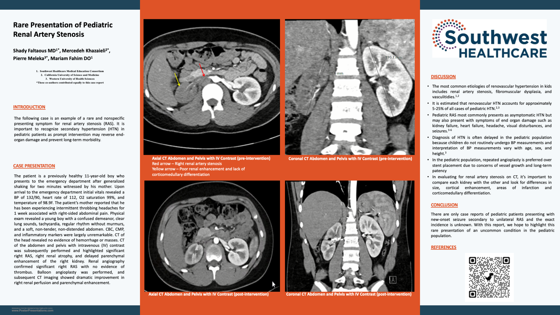 Rare Presentation of Pediatric Renal Artery Stenosis  .png