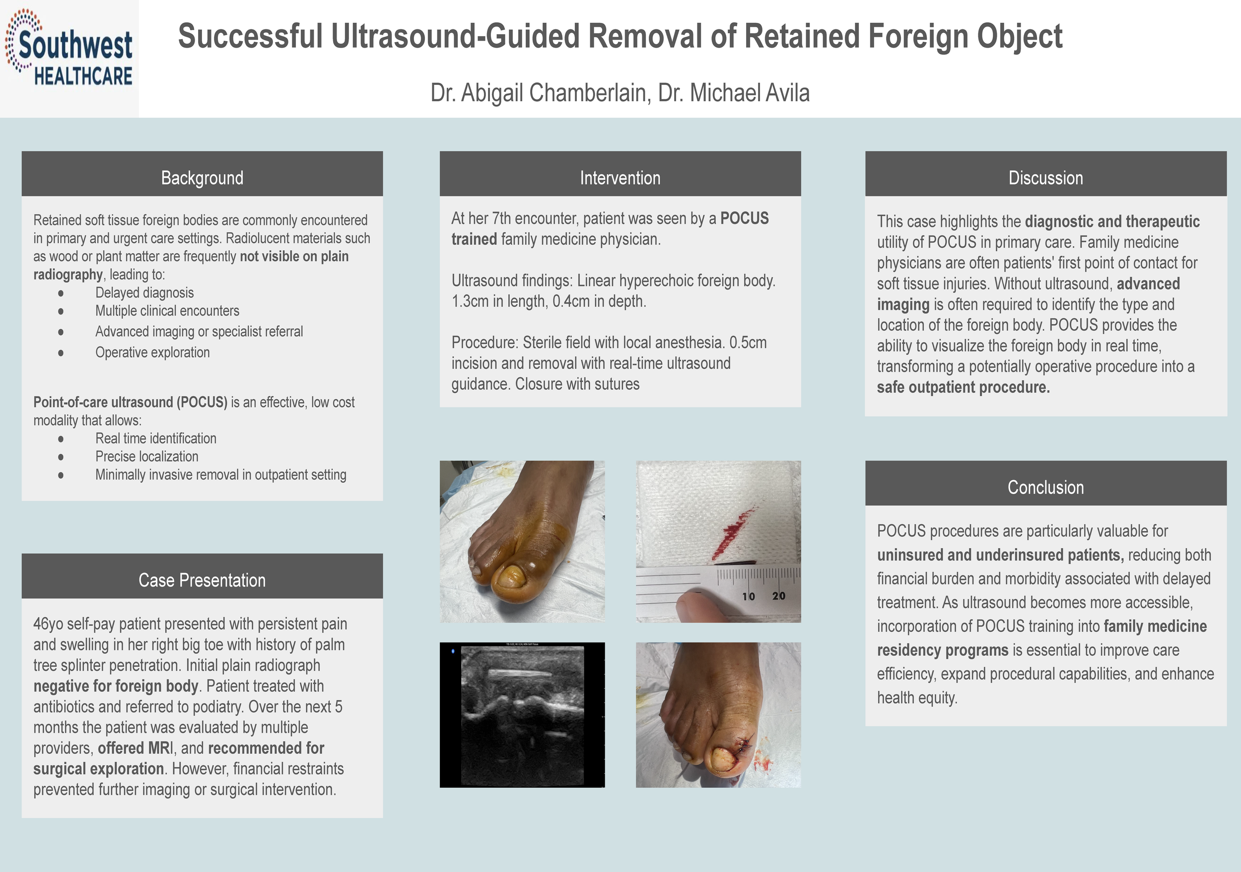 US Guided Removal.png