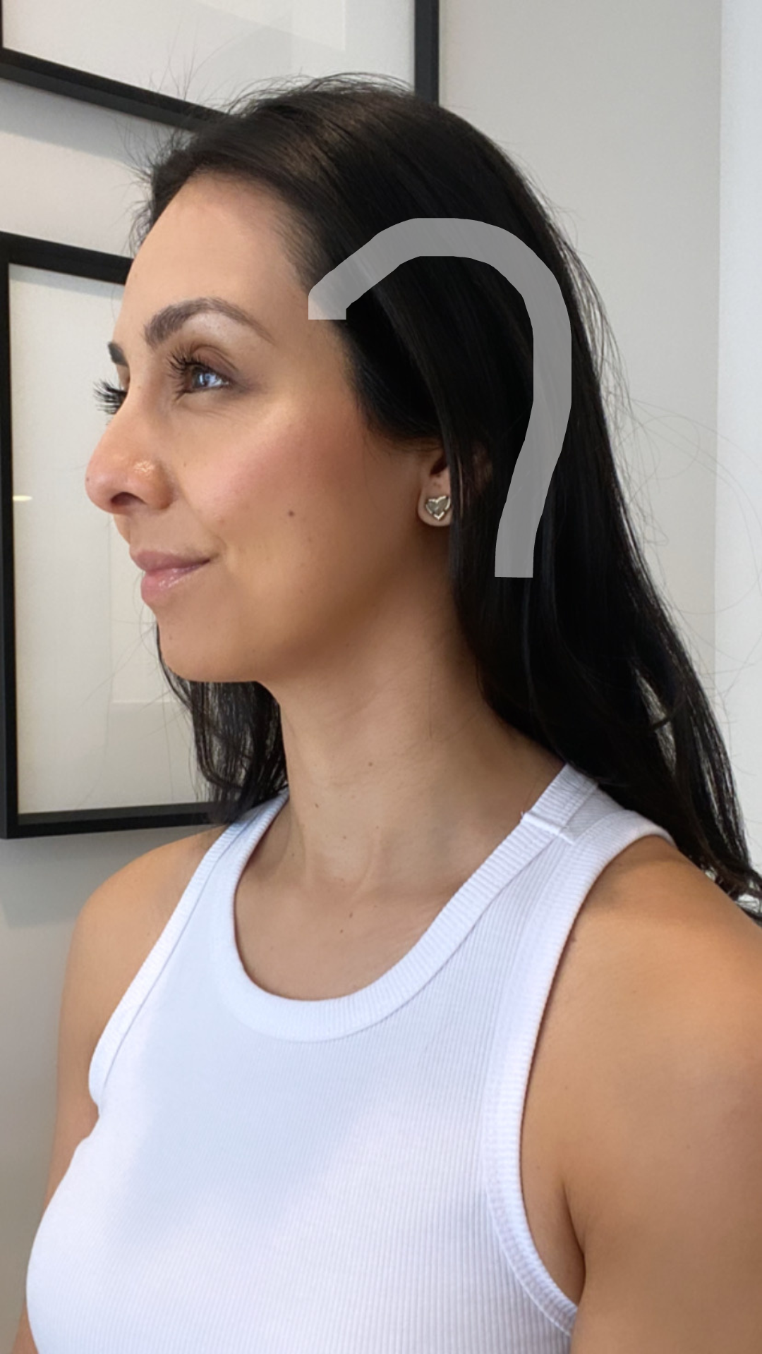 referred-pain-migraines-and-tension-headaches-mind-body-physiotherapy