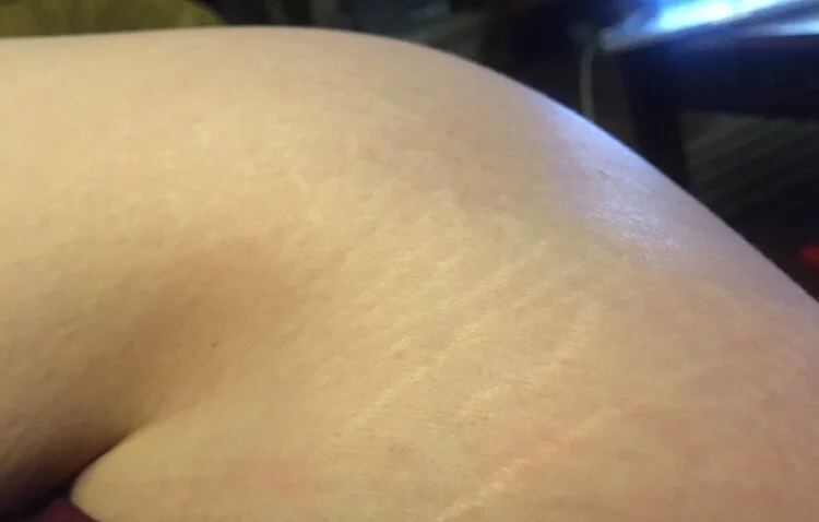 Lucille Frost and Allison Thompson