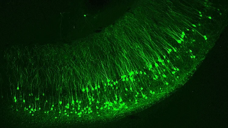 Research — Meyer Lab