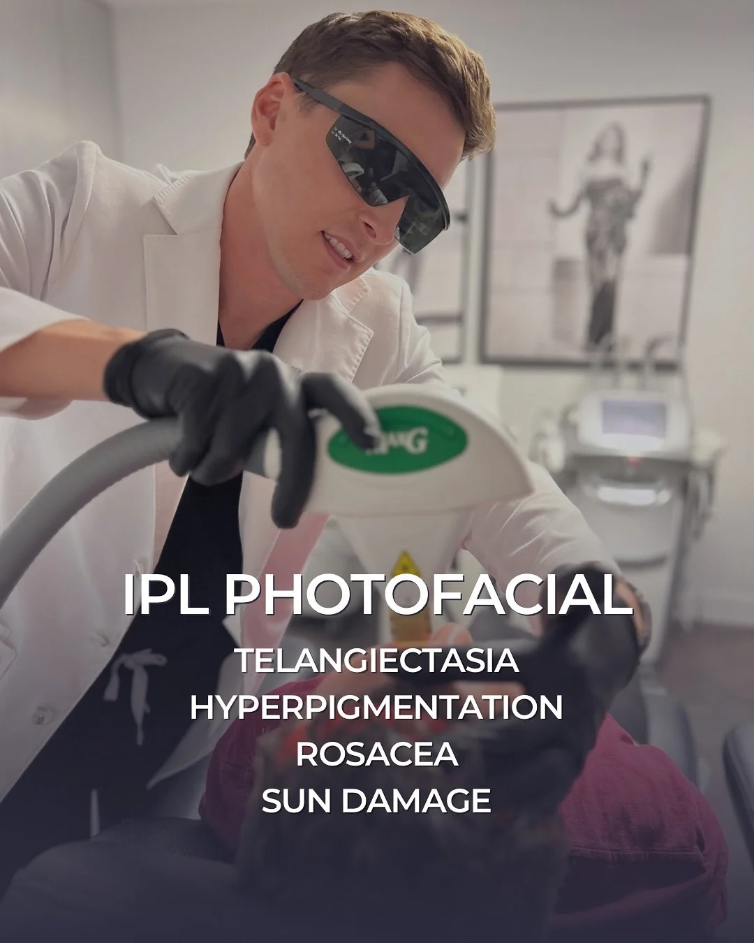 IPL is a fantastic treatment for treating redness, rosacea, broken capillaries and sun damage. 
The treatment almost always requires a series of sessions to gradually target a specific issue.
#ipl #rosacea #telangiectasias #sundamage