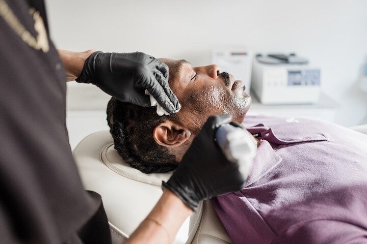 When it comes to caring for our skin and taking advantage of the available technologies, we cannot pass up MICRONEEDLING. ⁠
⁠
This is a simple, very minimal down time, research-backed, accessible treatment that PROMOTES COLLAGEN by creating tiny inju