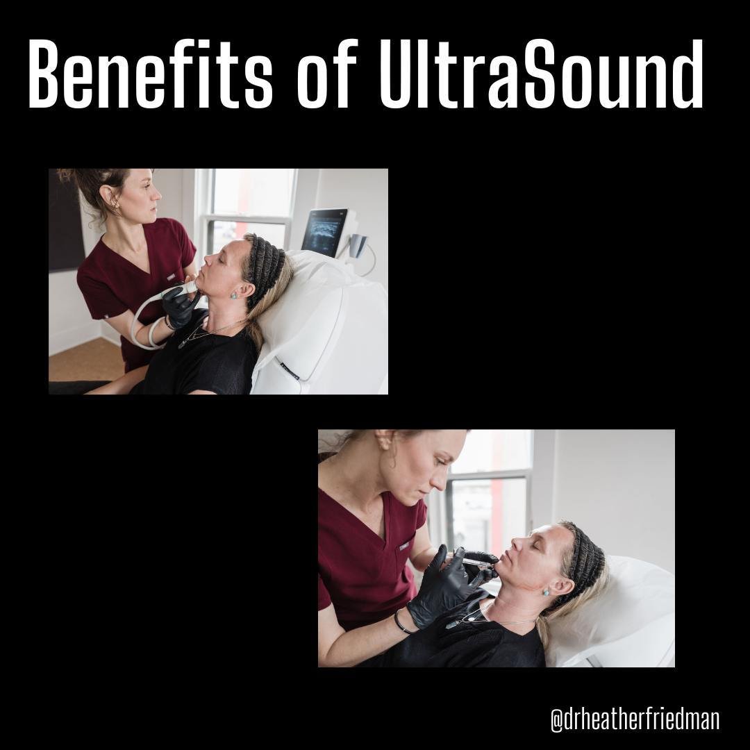I love my ultrasound machine and am committed to becoming more proficient with it.  Here are some reasons why an ultrasound is beneficial in facial aesthetics:⁠
⁠
Precision: when we integrate this technology into our treatments, we may enhance outcom