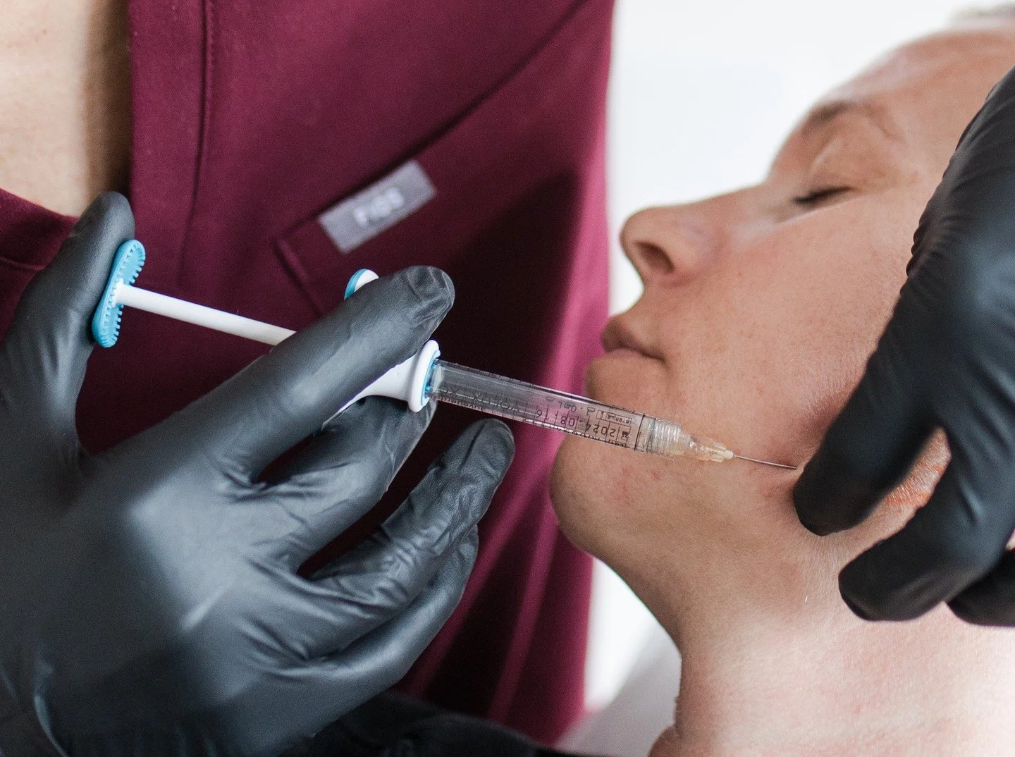 Love your results? Send a friend my way.

For every new patient you refer, you&rsquo;ll receive 5 complimentary units of Botox. No limit on how many referrals you can make.

#PDXBotox #PortlandAesthetics #PDXBeauty