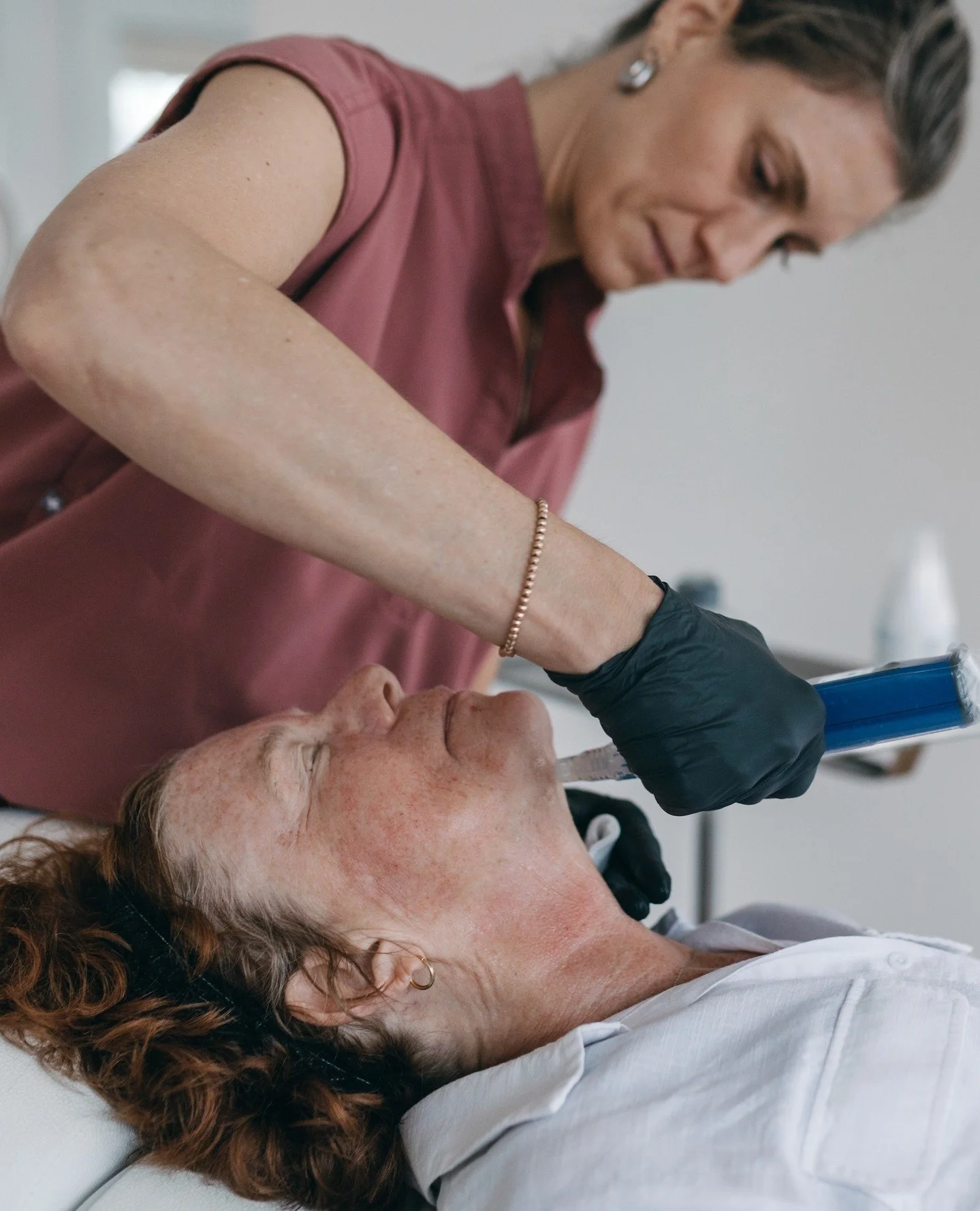 The Blood Facial is also known as microneedling with PRP.

For this treatment, we draw your blood, spin it in a centrifuge, and separate the platelet-rich layers. These are packed with your body&rsquo;s own growth factors, your built-in repair system